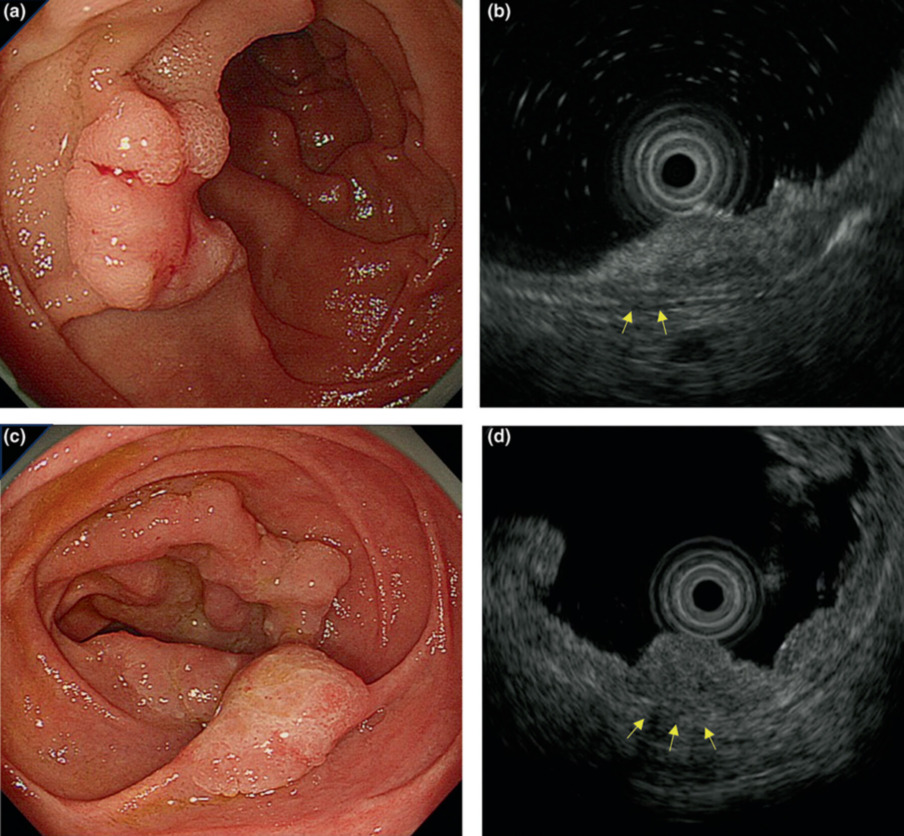 Cover Image Volume 36 Issue 8, 2024