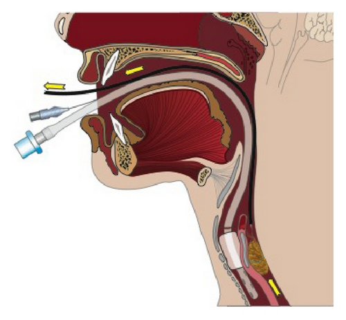 Details are in the caption following the image Details are in the caption following the image