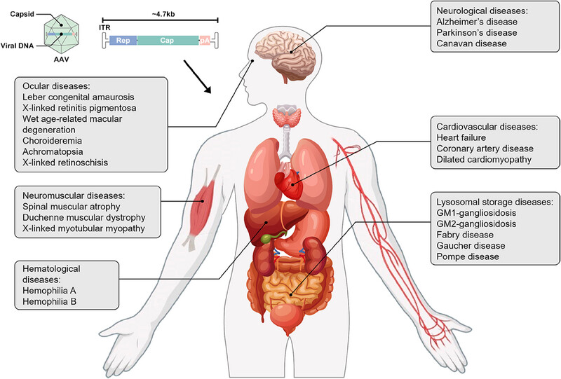 Current developments of gene therapy in human diseases