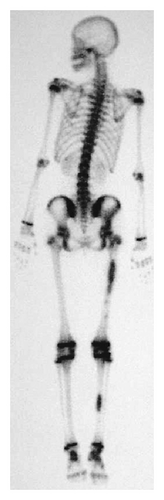 Details are in the caption following the image