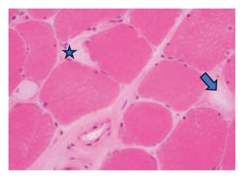 Details are in the caption following the image