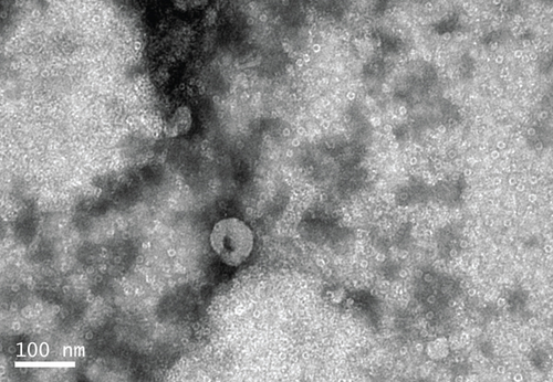 Details are in the caption following the image