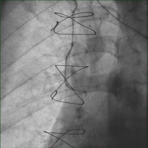 Details are in the caption following the image