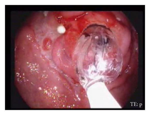 Details are in the caption following the image Details are in the caption following the image