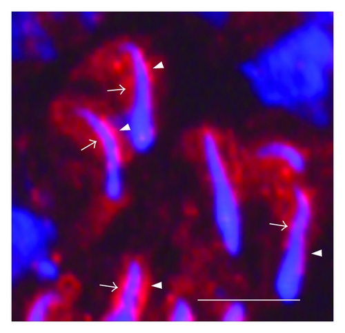 Details are in the caption following the image