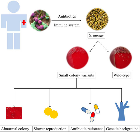 Characteristics of Staphylococcus aureus small colony variants isolated from wound specimen of a tertiary care hospital in China