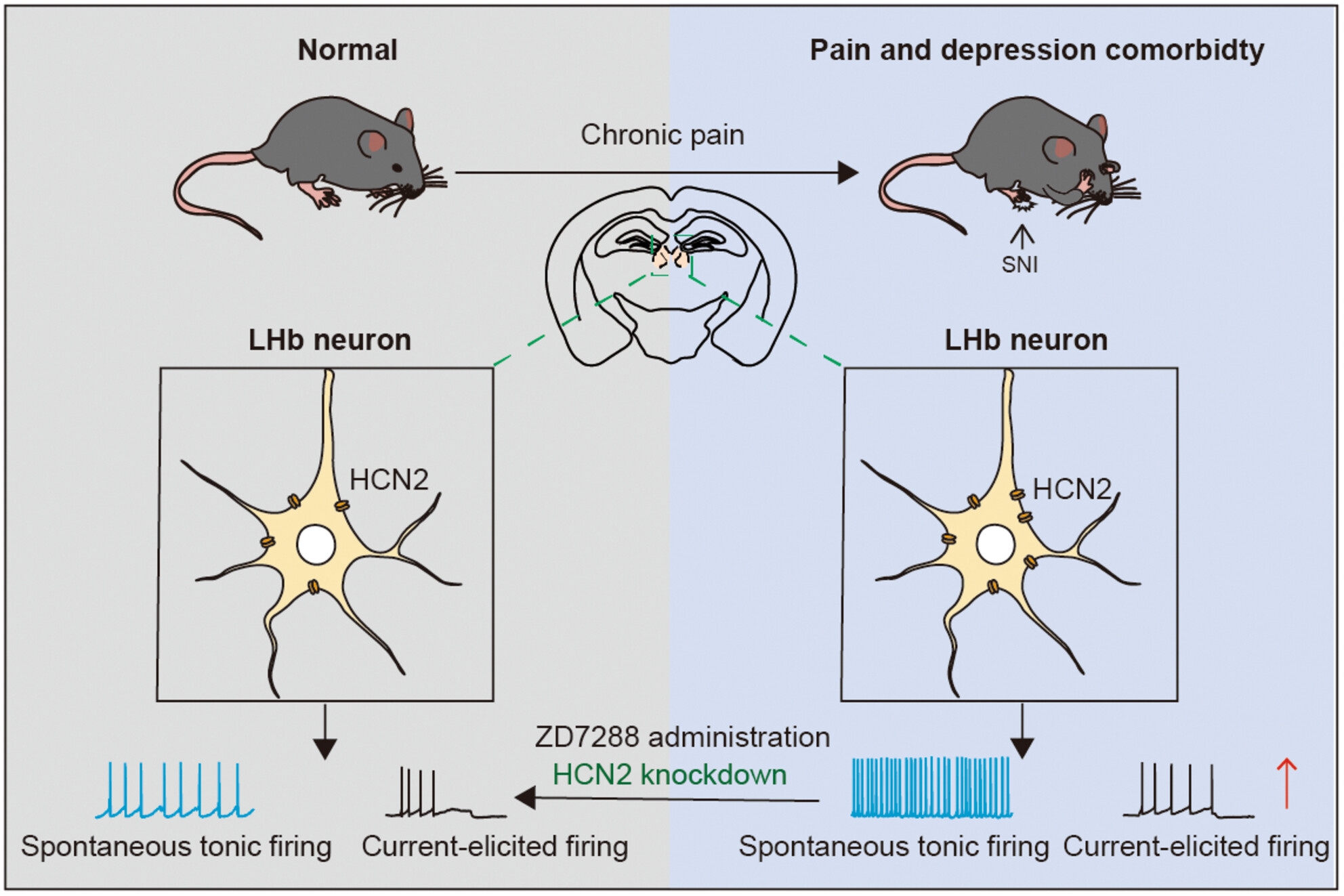 HCN channels in the lateral habenula regulate pain and comorbid depressive-like behaviors in mice