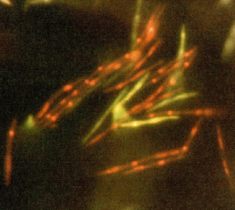 Effect of High Intensity Blue Light on Fusobacterium nucleatum Membrane Integrity