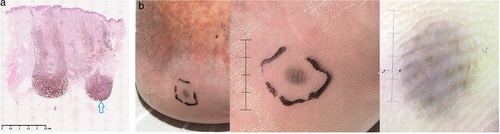 Details are in the caption following the image Details are in the caption following the image