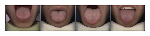 Details are in the caption following the image Details are in the caption following the image
