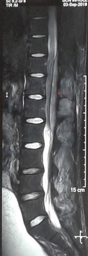 Details are in the caption following the image