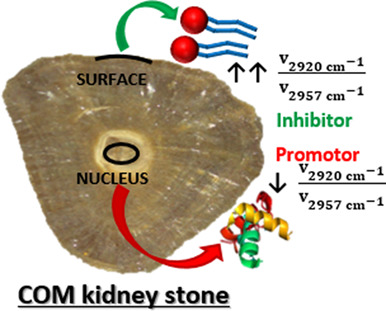 Calcium oxalate kidney stones, where is the organic matter?: A synchrotron based infrared microspectroscopy study