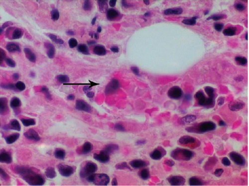 Details are in the caption following the image