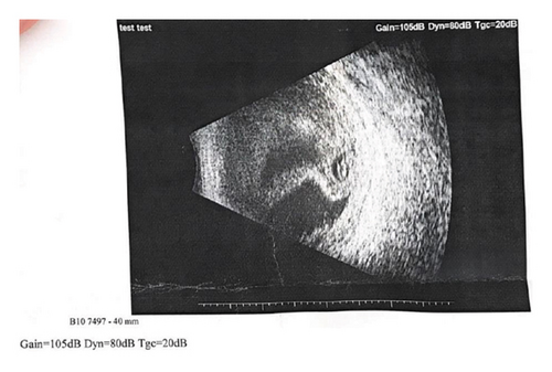 Details are in the caption following the image