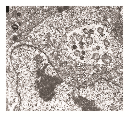 Details are in the caption following the image