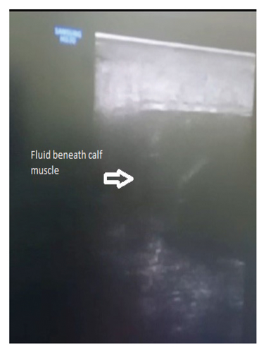 Details are in the caption following the image