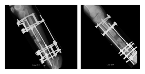 Details are in the caption following the image Details are in the caption following the image
