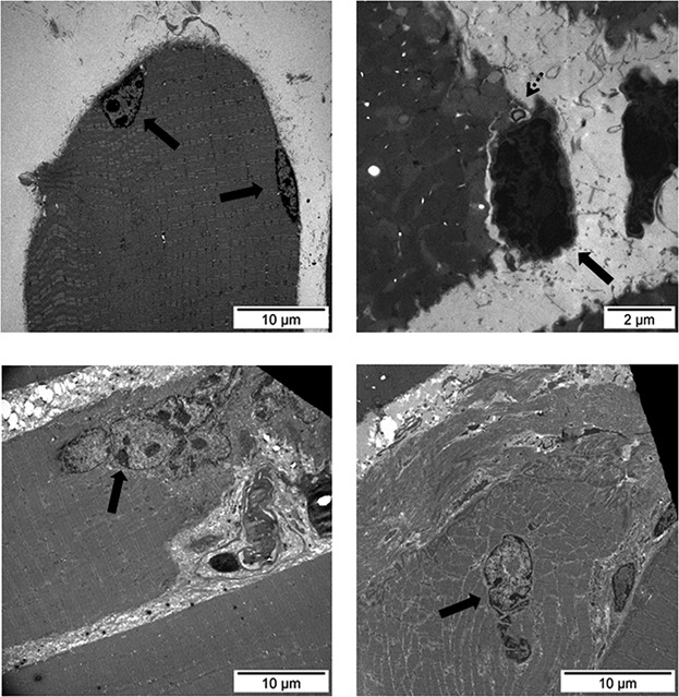 Muscle regeneration potential and satellite cell activation profile during recovery following hindlimb immobilization in mice