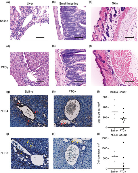 Post-transplant cyclophosphamide limits reactive donor T cells and delays the development of graft-versus-host disease in a humanized mouse model