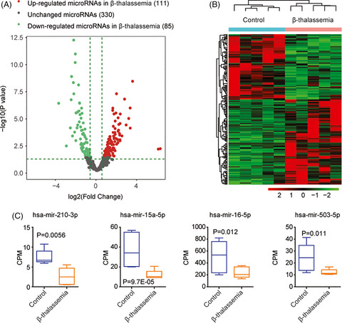 Abnormal regulation of microRNAs and related genes in pediatric β-thalassemia