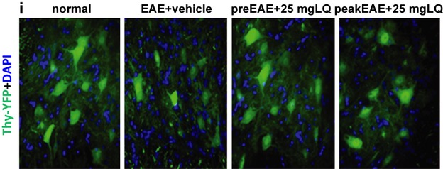 Therapeutic laquinimod treatment decreases inflammation, initiates axon remyelination, and improves motor deficit in a mouse model of multiple sclerosis