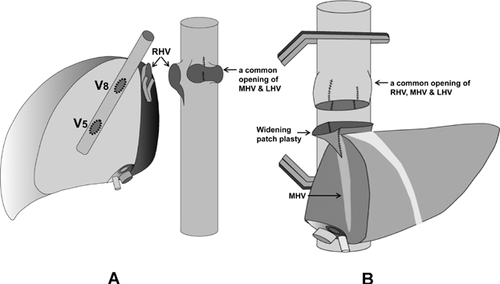 Details are in the caption following the image Details are in the caption following the image