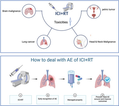 Safety and potential increased risk of toxicity of radiotherapy combined immunotherapy strategy
