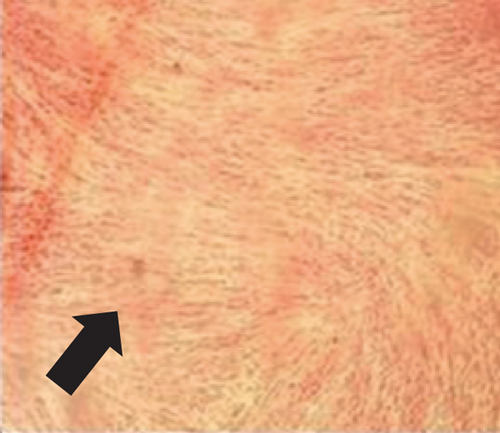 Details are in the caption following the image