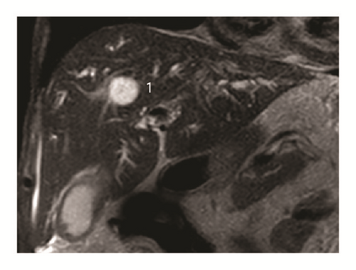 Details are in the caption following the image