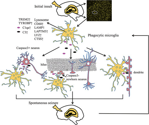 Bioinformatic analysis identifies key transcriptome signatures in temporal lobe epilepsy
