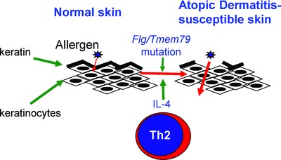 Increased Th2 activity and diminished skin barrier function cooperate in allergic skin inflammation