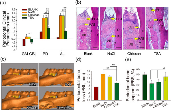 Epigenetic modifier trichostatin A enhanced osteogenic differentiation of mesenchymal stem cells by inhibiting NF-κB (p65) DNA binding and promoted periodontal repair in rats