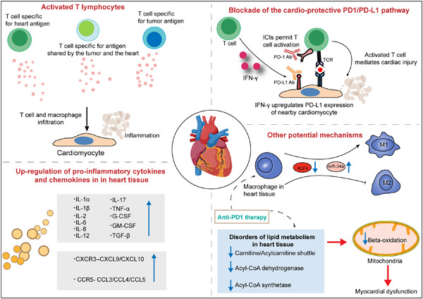 Immune checkpoint inhibitor-related myocarditis in thymic epithelial tumors: Recent progress and perspectives
