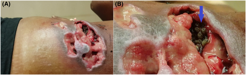 Details are in the caption following the image Details are in the caption following the image