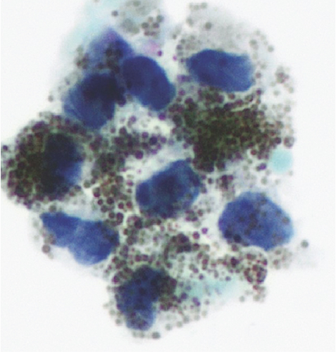 Details are in the caption following the image
