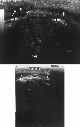 Details are in the caption following the image