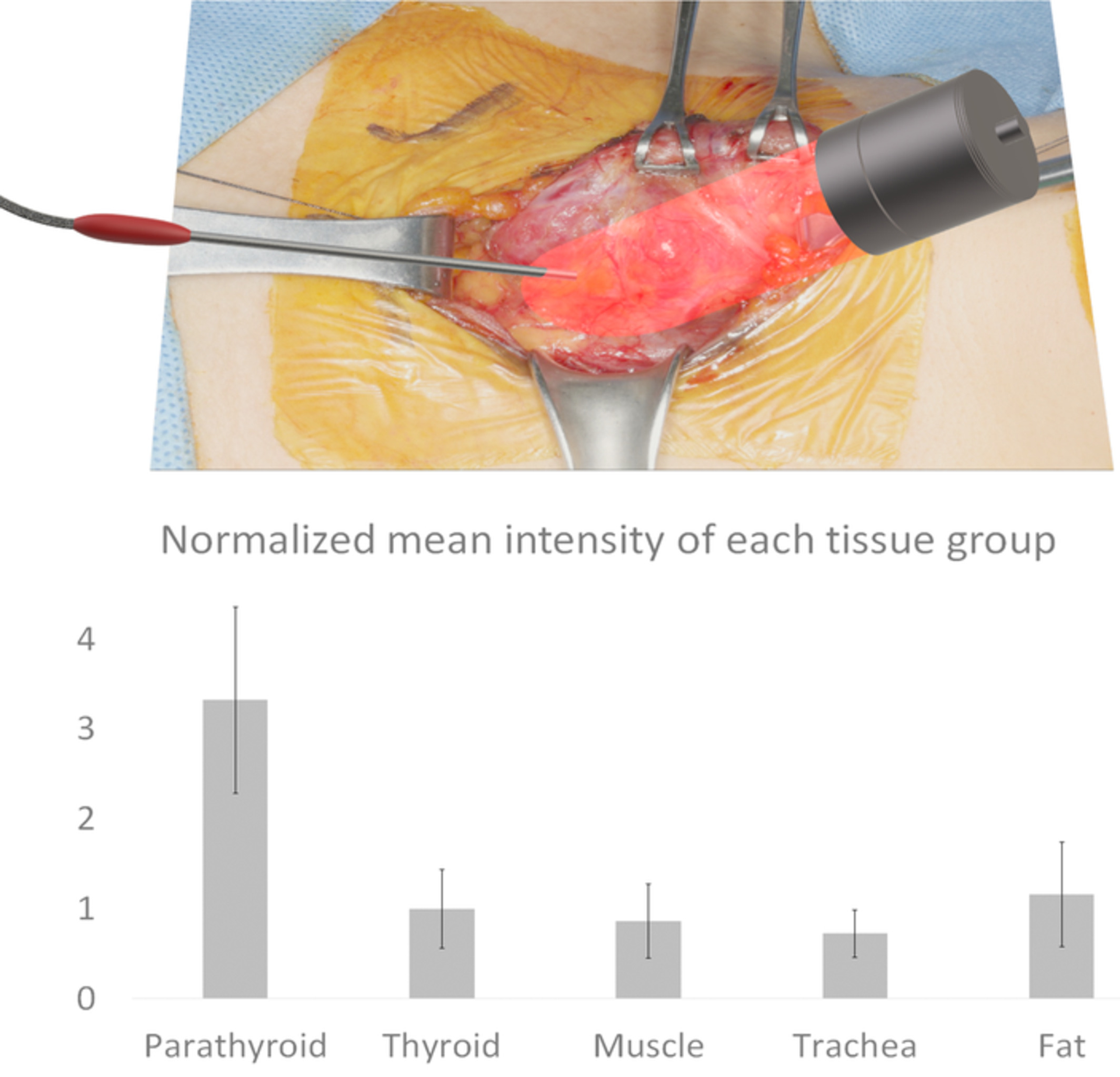 Phase-sensitive fluorescence detector for parathyroid glands during thyroidectomy: A preliminary report