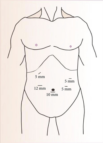 Details are in the caption following the image Details are in the caption following the image
