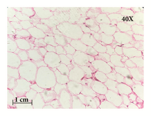 Details are in the caption following the image