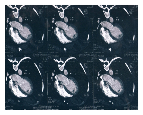 Details are in the caption following the image