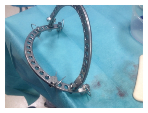 Details are in the caption following the image Details are in the caption following the image