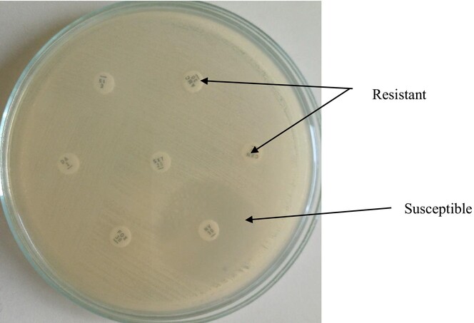 The Bacterial Species Behind the Wound and Their Antibacterial Resistant Pattern: A Three-Year Retrospective Study at St. Dominic Hospital, Akwatia, Ghana