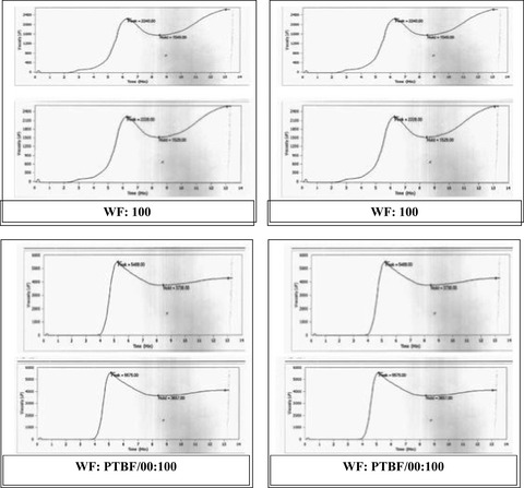 Effects of pretreatments of banana (Musa AAA,Omini) on the composition, rheological properties, and baking quality of its flour and composite blends with wheat flour