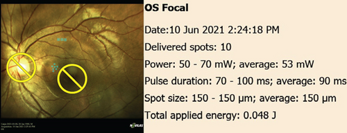 Details are in the caption following the image Details are in the caption following the image