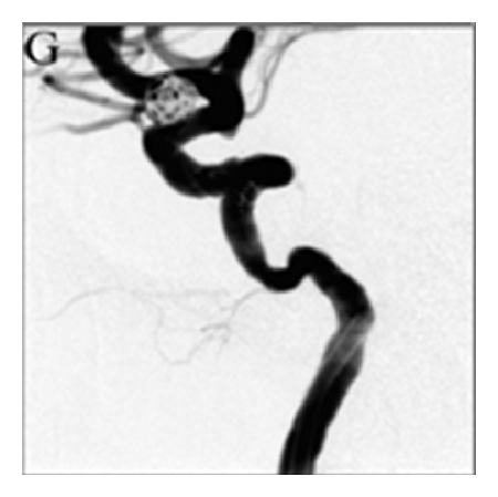 Details are in the caption following the image
