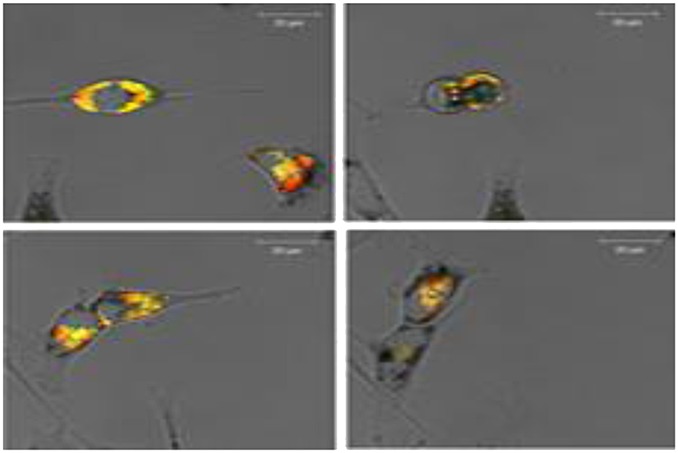 Compartmentalization of Gd liposomes: the quenching effect explained