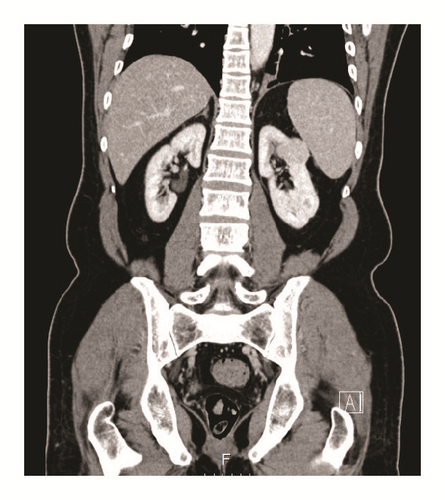 Details are in the caption following the image