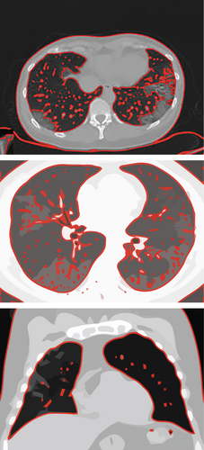 Details are in the caption following the image