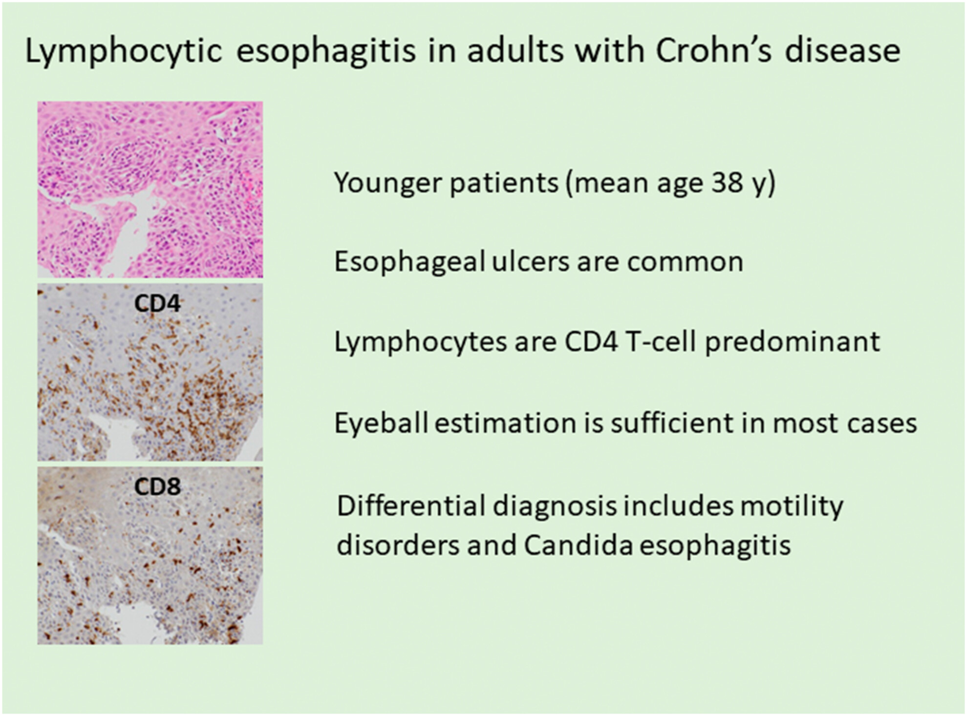 Clinicopathological and immunophenotypical characterisation of lymphocytic oesophagitis in adults with Crohn's disease