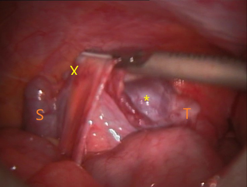 Details are in the caption following the image Details are in the caption following the image